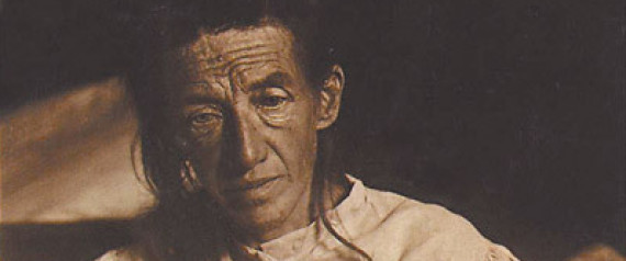 AUGUST DETER ALZHEIMER