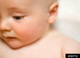 Study Finds Early Signs Of Autism In Baby Brains