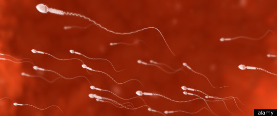 Ultrasound Male Contraception