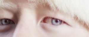 Albinoeyesight