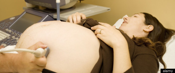 Diabetes Birth Defects