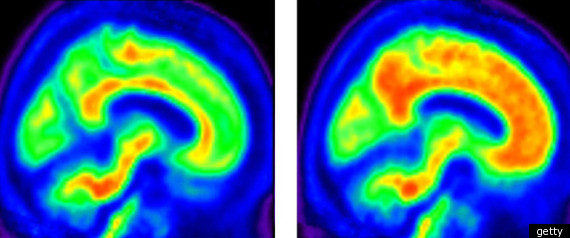Brain Scan