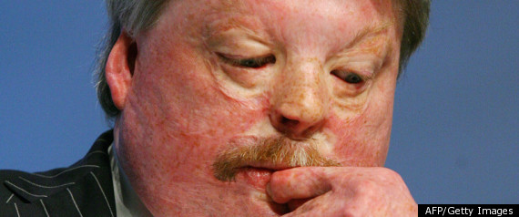 Simon Weston Before