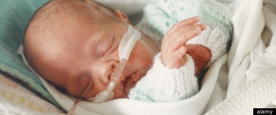 C Sections