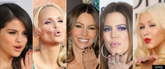 Kisses