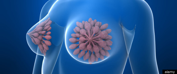 Breast Cancer Gene Testing