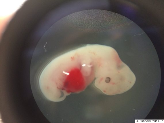 Pictures Of A Growing Human Embryo 62