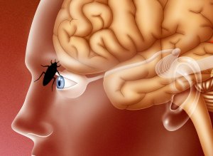 صرصور دخل جمجمتها وبقي حياً يتحرّك.. شاهد كيف أخرجه الأطباء!