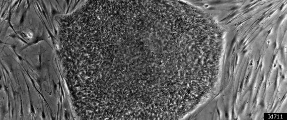 Stem Cell