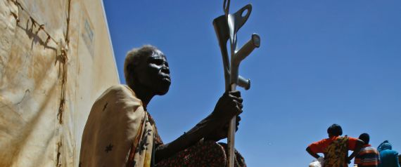 كيف تكتشف أن هذا البلد يتعرَّض للمجاعة؟.. كل ما تودُّ معرفته عن الوباء الذي يقتل الملايين