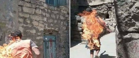 أحرقوه وصوَّروه للتسلية.. مطالب لإنزال أقصى العقوبات بيمنيين كادوا يقتلون مريضاً عقلياً
