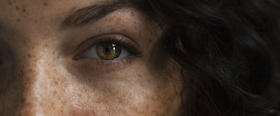 FRECKLE
