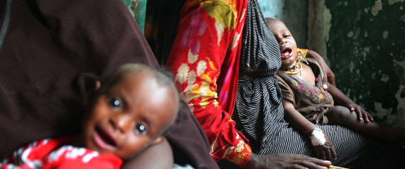 SOMALIA HUNGER