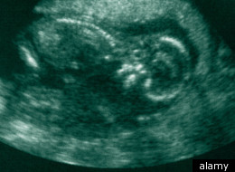 Catholic Midwives Lose Legal Fight To Avoid Assisting In Abortions