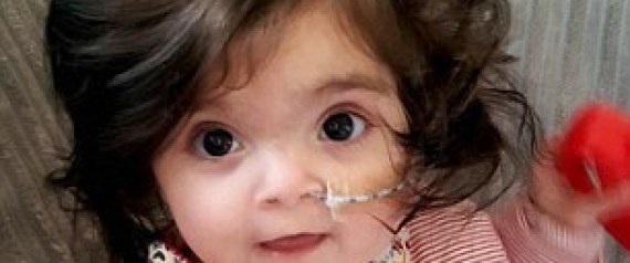 شبهوها بشخصية "بوو" والناس يظنونها ترتدي "باروكة".. قصة طفلة شعرها حيَّر كلَّ من شاهدها