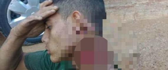 حمل رأسه شبه المقطوع مئات الأمتار.. شاهد كيف حافظ شابٌ على حياته بعد شجار مع عصابة بالبرازيل