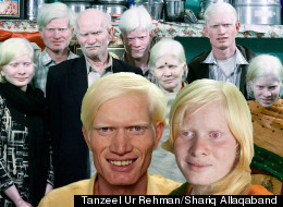 PICTURES: The World's Largest Family Of Albinos 