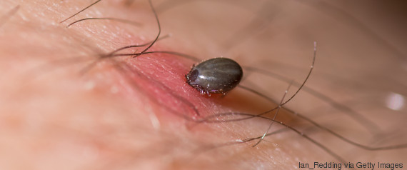 tick