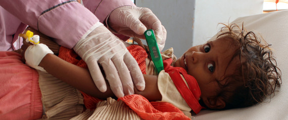 YEMEN CHOLERA