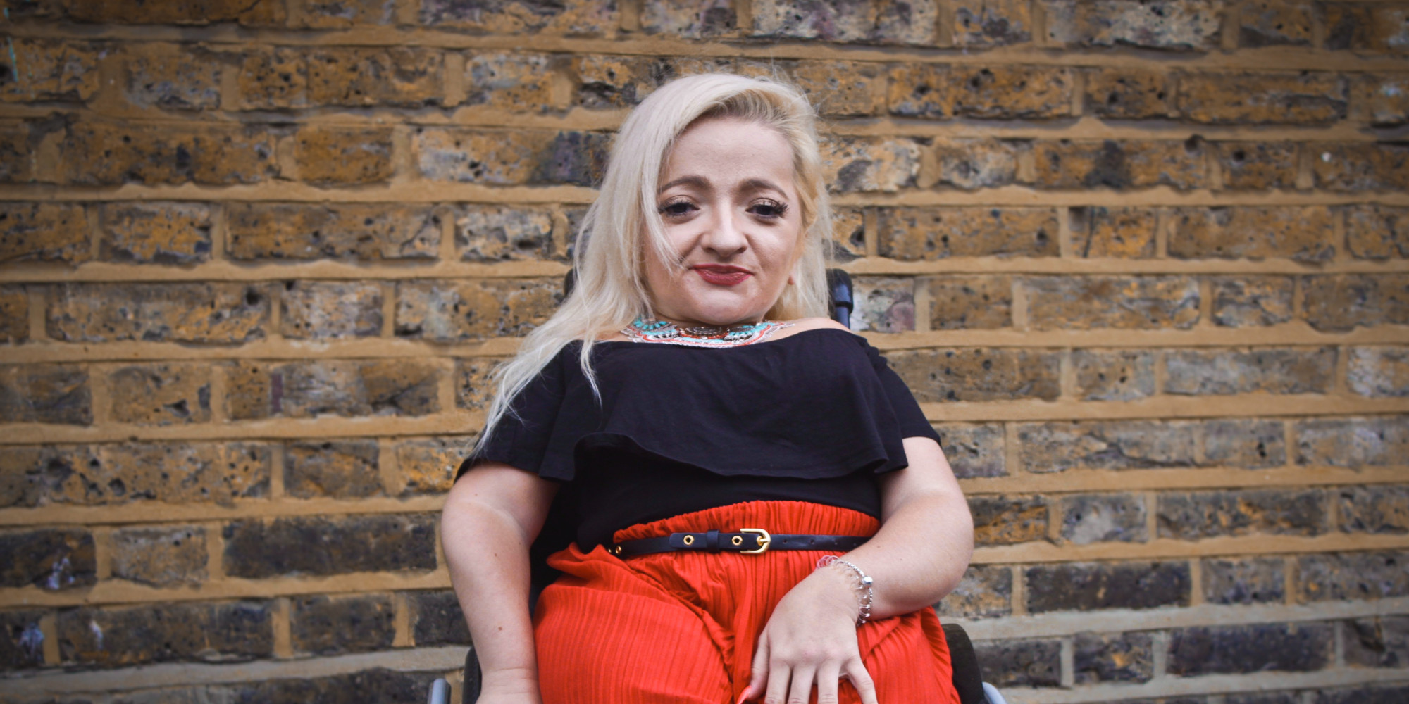 My Brittle Bone Condition Won't Stop Me Living Life To The Full