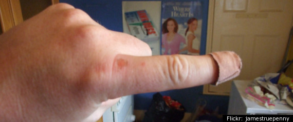 Ernest Vannier Finger
