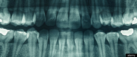 Xray