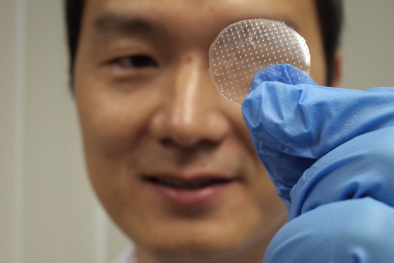 microneedles