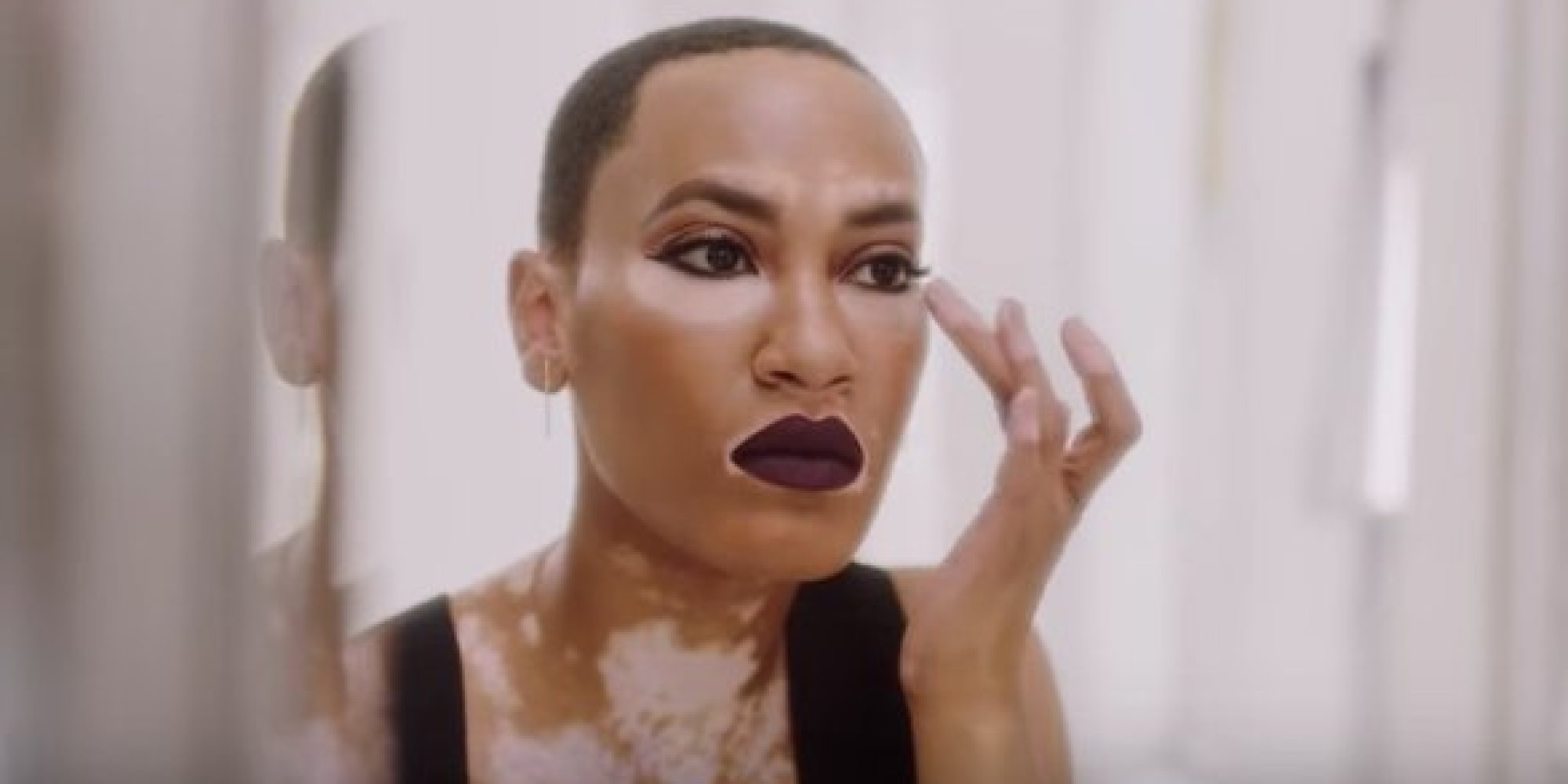 Cette mannequin atteinte de vitiligo est la nouvelle égérie d'une