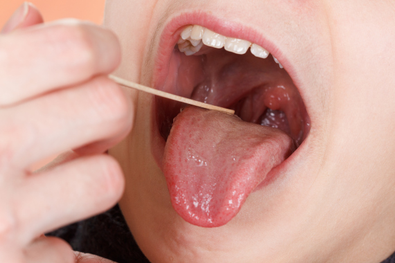 tonsils