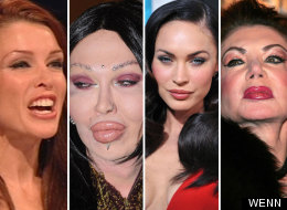 Surgery Celebs
