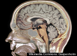 Garpenbrain