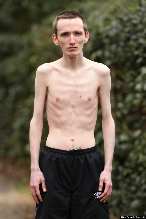 o-ANOREXIC-MARC-CORNS-570.jpg?1