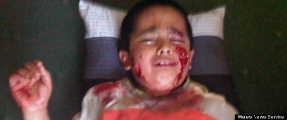 Dog Attack Erfan Ali