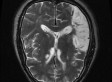 No 'God Spot' In Brain, Spirituality Related To Impaired Self Focus