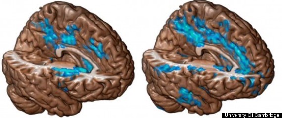 Cocaine Brain
