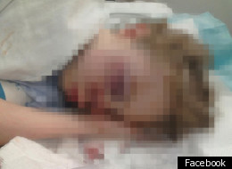 Seriously Injured Student