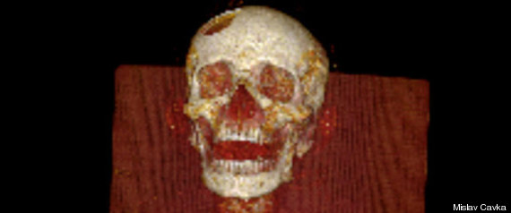 Mummyscansdisease1