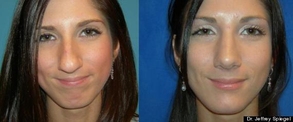 Implantes Menton