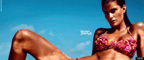 Bronceado1