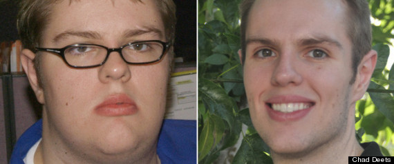 Weight Loss Success Chad Deets