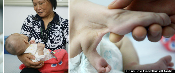 Sixleggedbabypreview