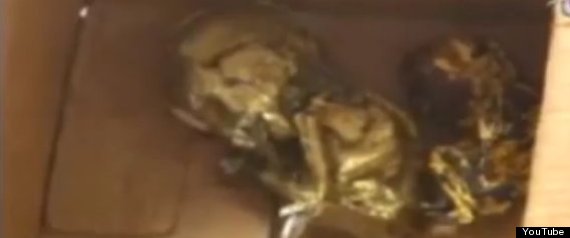 Gold Fetus
