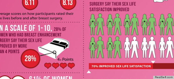 Breast Implants And Lifts Give You A Better Sex Life Poll Finds