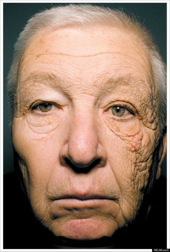 bill mcelligott sun damage