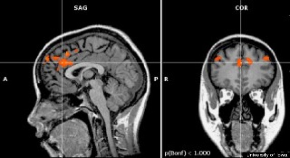 brain selfcontrol