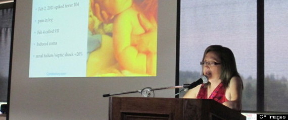 Cyndi Desjardins Flesh Eating Disease