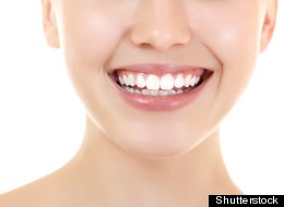 ¡Enséñame tus dientes! Consejos para una sonrisa hermosa
