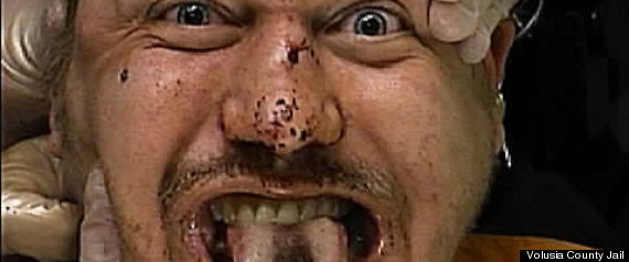 Mugshot Dui Blood