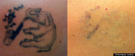 Detatouages