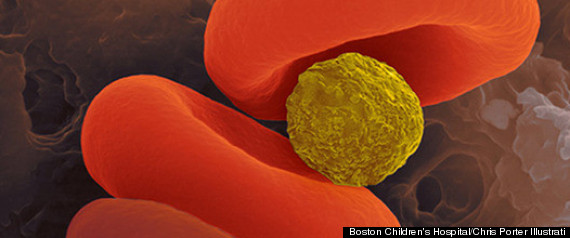 Oxygen Microparticles